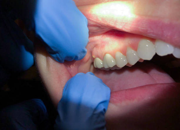 Best Pediatric Emergency Dentist in Spring Hill, KS
